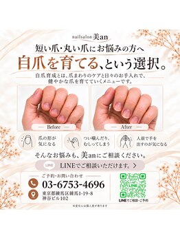 美an 練馬の写真/自爪育成＊深爪/噛み癖/いじり癖など爪の形にコンプレックスがある方の自爪育成をサポートさせて頂きます！