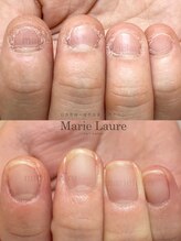 マリーロール 淀屋橋本店(Marie Laure)/自爪育成/深爪矯正/ネイルケア
