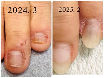 グレースレディ 大阪店/1年後の経過