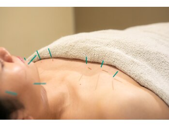 グリットグリン(GRIT GRIN)/身体鍼灸