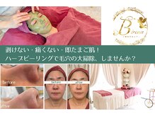 ビレナ(Birena)