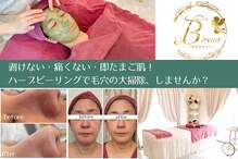 ビレナ(Birena)