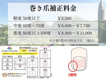 巻き爪料金の仕組み