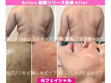 CBDサロン ローズ(ROSE)