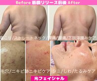 CBDサロン ローズ(ROSE)