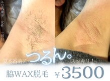 エット(ett)