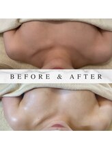 ヘブンビューティー(Heaven Beauty)/