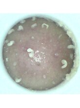 ビーアンドアイ シズオカテン メンズ(B＆I SHIZUOKA)/ベタつきテカリの原因