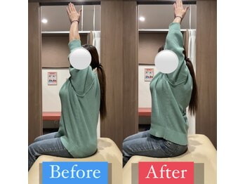ナオル整体 宮崎院(NAORU整体)/30代女性施術事例【可動域改善】
