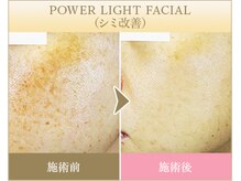 ビューティースペース 品川大井町店(Beauty Space)/光フェイシャル