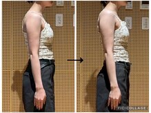 ソリ(soli)/before→after写真