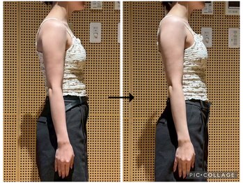 ソリ(soli)/before→after写真