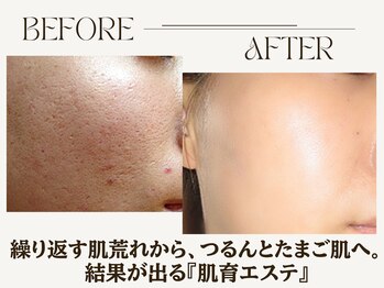 パルテールの写真/初めての方も安心◎創業46年のフェイシャル専門店で肌悩みに合わせた肌改善ケアをまずは1度ご体感ください