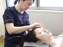 整美堂 ハリヤ美容鍼灸 大宮駅前院(HARIYA)/鍼灸師が丁寧に施術