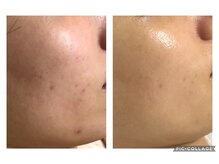 オアジスパ(Oasi Spa)/