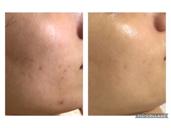 オアジスパ(Oasi Spa)/