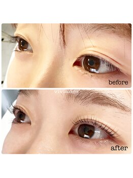 ヴィヴィアンジュ(viviange)/ラッシュリフト