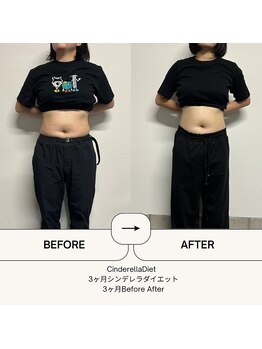 オーシャン整骨院(OCEAN整骨院)/3ヶ月コース