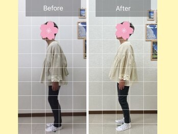 ナオル整体 大宮院(NAORU整体)/大宮/整体・猫背矯正・骨盤矯正