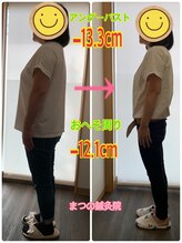 まつの鍼灸院/身体の厚みが薄くなられました