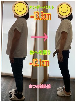 まつの鍼灸院/身体の厚みが薄くなられました