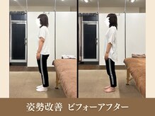 オリエンタル整体院 新潟院/20代 営業職 姿勢改善成果