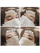 ビビ(vivi)/WAX脱毛