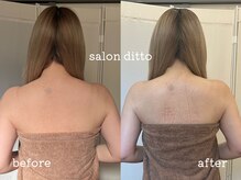 サロンディト(ditto)/炭酸ケアで後ろ姿にも自信を♪