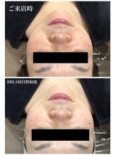 ホッコリ 段原店(HOKKORI)&nbsp;HOKKORI 