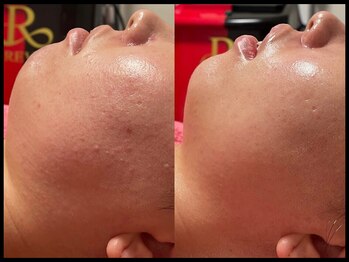 ゾーンビューティーハウス 松戸店(ZONE BEAUTY HOUSE)/