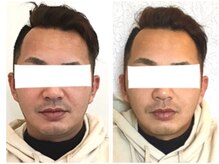 美容整体ウェリナ あま甚目寺院/小顔矯正/骨盤矯正/美脚サロン