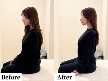 ソレア(Solea)/肩こり・首こり改善1回目