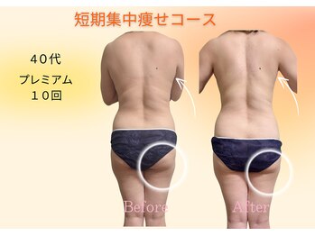 ヨサパーク リボーン(YOSA PARK Reborn)/劇的ビフォーアフター/痩身駒込