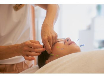 ハリ ヴァカンス(Hari Vacances)の写真/むくみ・食いしばりでぼやけた輪郭に◎顔筋リフト美容鍼