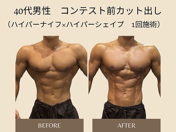 オベリオ(OBERIO)/コンテスト選手用カット出し施術