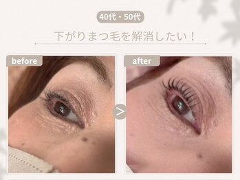 アイラッシュサロン ルッカ(eyelash salon Lucca)/下がりまつ毛でお悩みの方