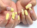 イエロー×クロムパーツ×レース