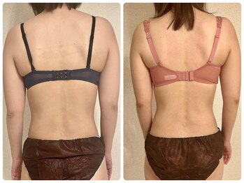 プリマ(prima)/施術症例