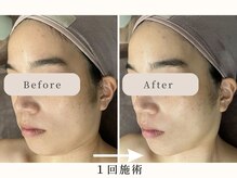 イト(ito)/お肌もトーンアップ♪