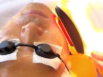 ビビ イーストフィールド 天白 名古屋(vivi)の写真/【メンズ大歓迎】最新マシンで痛み軽減◎今までにないヒゲ脱毛×肌質改善◎安心都度払い