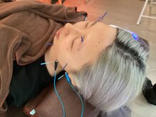 ハリファ鍼灸院 横浜関内院(HariFa鍼灸院)/美容施術/美容鍼