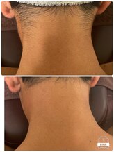 エン(en.)/BeforeAfter写真45