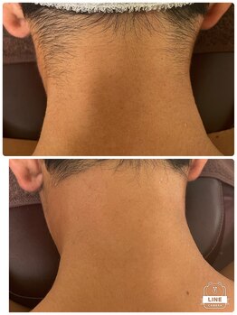 エン(en.)/BeforeAfter写真45