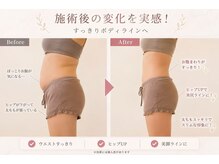 イトウサロン(ITO SALON)の雰囲気（気になるお腹・太ももを集中ケア◎理想のすっきりボディラインへ）