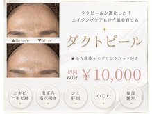 ソレラ(sorelle)