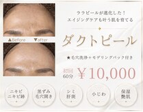 ソレラ(sorelle)