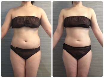 美容整体ウェリナ あま甚目寺院/小顔矯正/骨盤矯正/美脚サロン