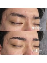 ハービー 高岳店(HARVEY)/お客様施術例