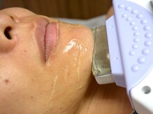 エピラージュ 町田店/ヒゲ脱毛ツルツルを目指せます！