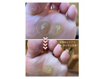 ココン フワット(cocon fouato)の雰囲気（定期的にケアをすることでトラブルは改善します。銀座一丁目）